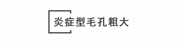停止伤害你们的毛孔！毛孔粗大其实还有救!