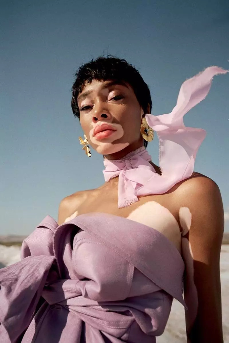 Winnie Harlow