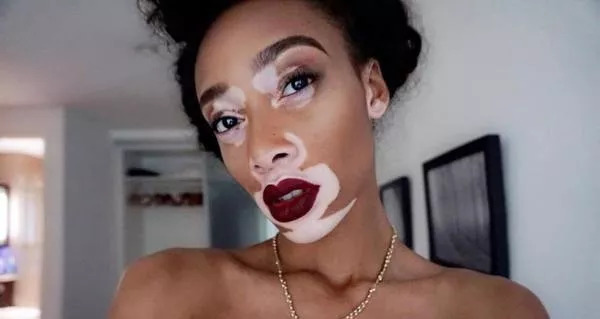 Winnie Harlow